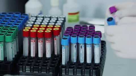 Coagulation sodium citrate, Hand takes several test vacuum tubes with different Stock Footage 276366828