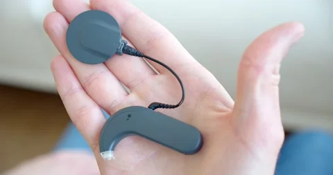 Cochlear implant on the palm, the latest model Stock Footage 172236689