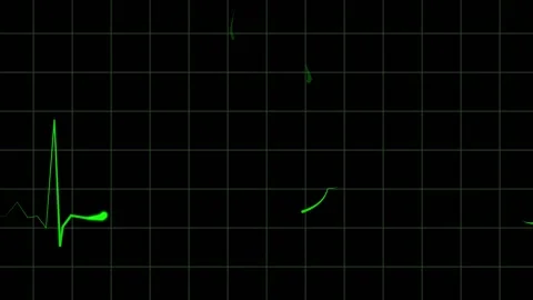 Coffee Heartbeat with Audio Stock Footage 166911277