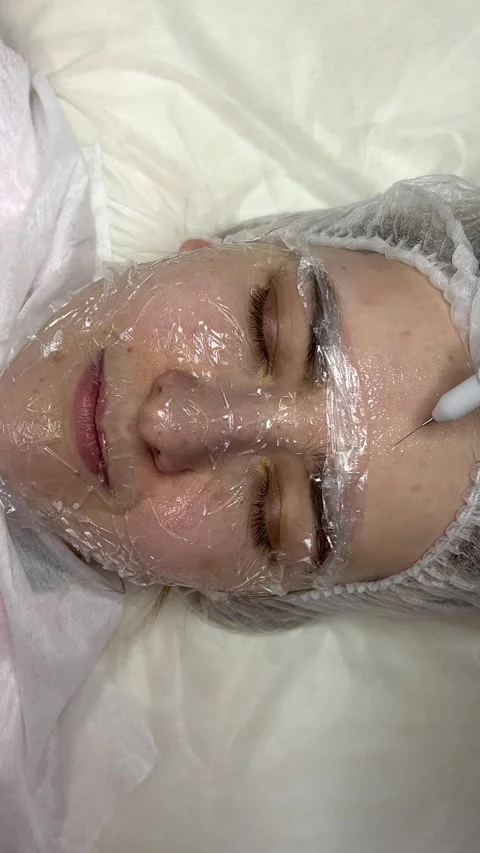 A cold plasma or non-equilibrium plasm for skincare. Removing dark spots Stock Footage 307284346