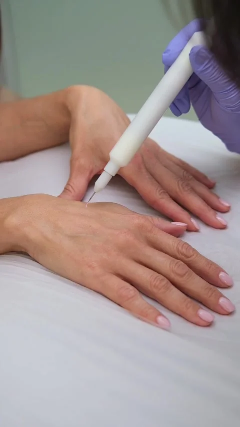 A cold plasma or non-equilibrium plasm for skincare. Removing dark spots Vídeos de archivo 318369901