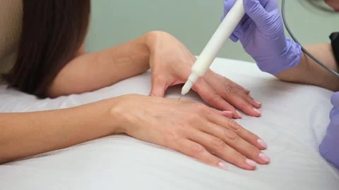 A cold plasma or non-equilibrium plasm for skincare. Removing dark spots Vídeos de archivo 318370003