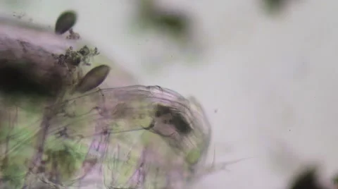 Coleps Ciliate, Microscopy Stock Footage 56082277
