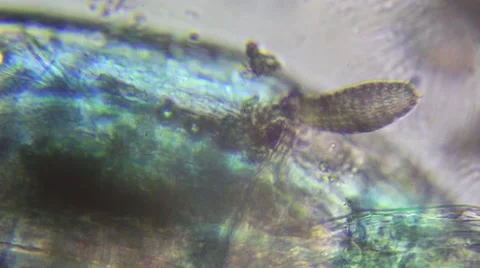 Coleps Ciliate, Microscopy Stock Footage 56082359