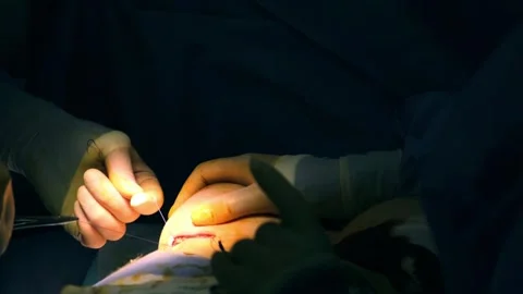 A collaborating team of surgeons performs surgery in a modern operating room. Stockbeeldmateriaal 270546499