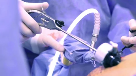 A collaborating team of surgeons performs surgery in a modern operating room. Stockbeeldmateriaal 270552518