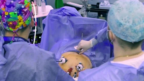 A collaborating team of surgeons performs surgery in a modern operating room. Stockbeeldmateriaal 270554903