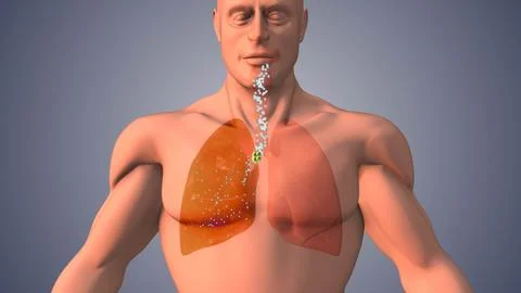 Collapsed Lung Condition Reducing Oxygen and Airflow Efficiency 00275 Illustrazione stock