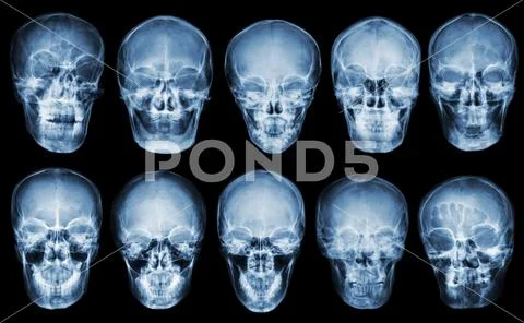 Collection of asian skull . front view . isolated background . Stock Photos