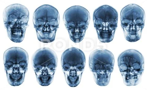 Collection of asian skull . front view . isolated background . Stock Photos