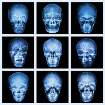 Collection of asian's skull Stock Photos