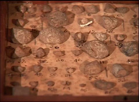 Collection of bladder stones collected by one woman in Leiden Anatomical Museum Stock Footage 164341518