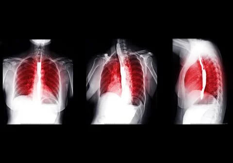 Collection of Esophagram. Stock Illustration