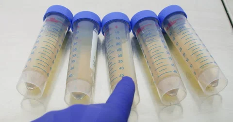 A collection of liquid medications Stock Footage 317883396