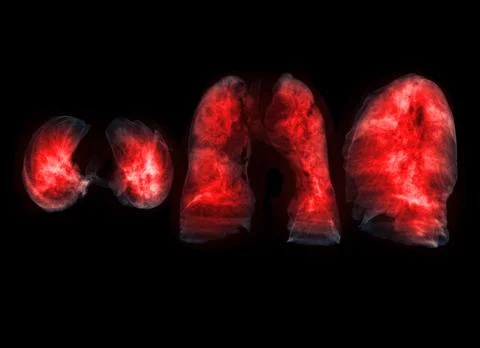 Collection of Lung 3D rendering image. Stock Illustration