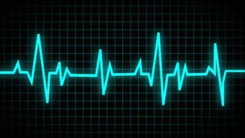Collection of normal and abnormal ECGs. Vector of an electrocardiogram, ecg.. Stock Photos