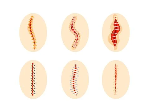 Collection of round icons representing various sutured wounds in different Stock-Illustration