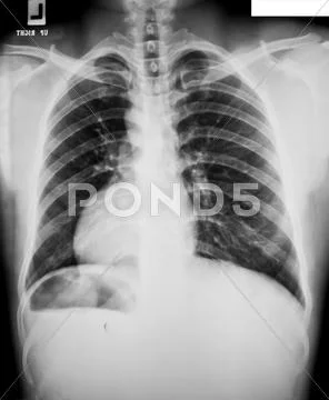 Collection of x-ray Stock Photos