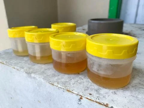 A collection of yellow urine samples on the table for laboratory examination Stock Photos