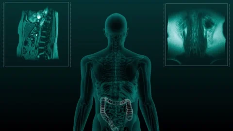 Colon MRI Stock Footage 263561724