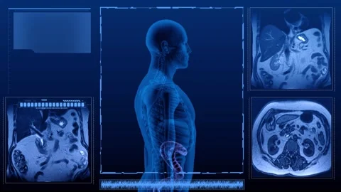 Colon MRI multi Stock Footage 268486718