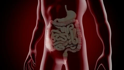 Colon Polypectomy 스톡 동영상 121565282