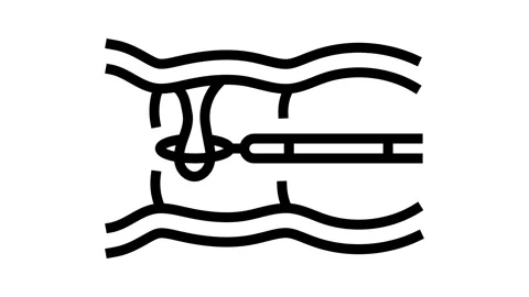 Colon polyps gastroenterologist line icon animation Video stock 326132220