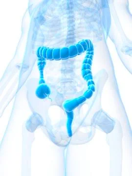 Colonic spasm; artwork Stock Illustration