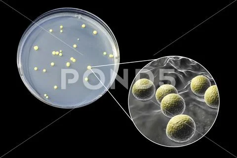 Colonies of Micrococcus luteus bacteria on agar plate ~ Premium Photo ...