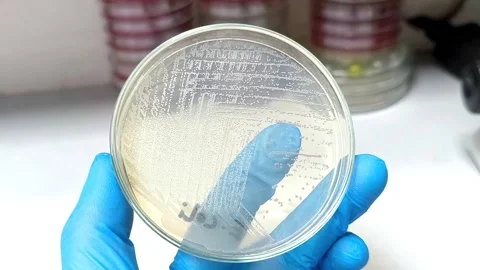 Colonies of the pathogenic bacterium Escherichia coli (E. coli) Video stock 337722608