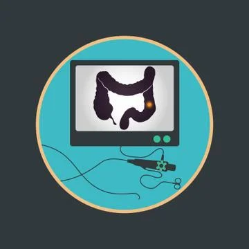Colonoscopy procedure used for screening colon diseases Stock Illustration