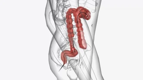 Colonoscopy is a procedure in which a do... | Stock Video | Pond5