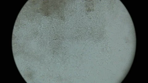 Colony of bacteria-cadaveric fingers under the microscope Stock Footage 85632010