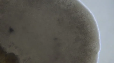 Colony of bacteria 動画素材 64826320