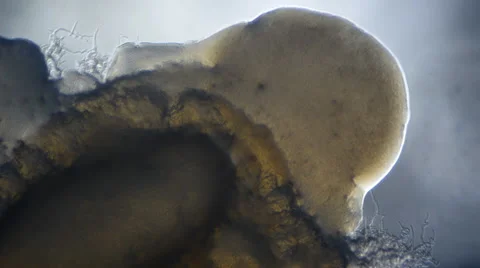 Colony of bacteria Stock-Footage 64826357