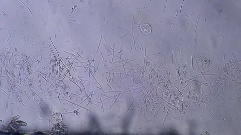 Colony of bacteria, microscope magnification Stock Footage 167275403