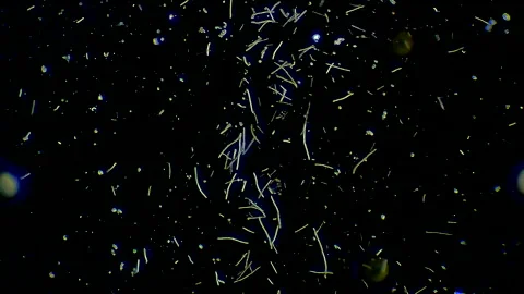 Colony of bacteria, microscope magnification Stock Footage 167275430