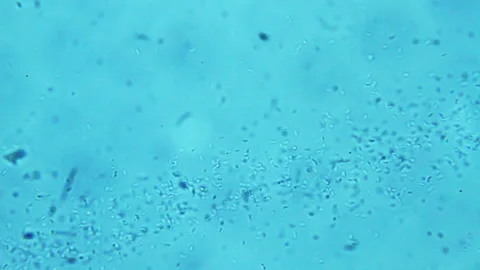 Colony of bacteria, microscope magnification Stock Footage 167306477