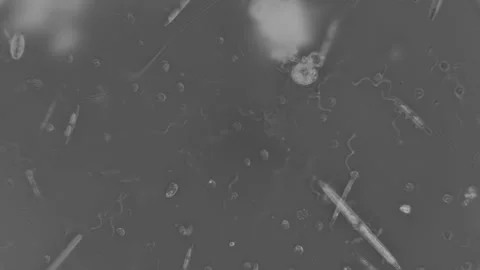 Colony of bacteria spirochetes under a microscope Stock Footage 90374063