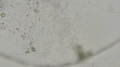 Colony of bacteria spirochetes under a microscope Stock Footage 91950246