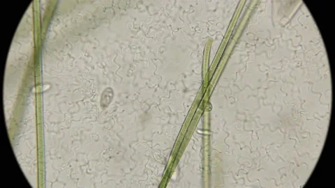 Colony of bacteria spirochetes under a microscope Stock Footage 96005968