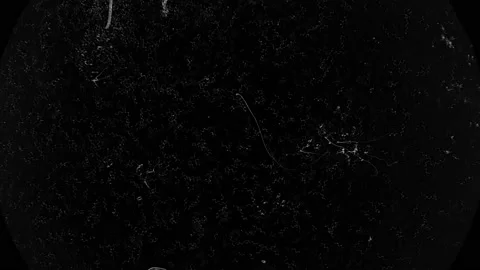 Colony of bacteria spirochetes under a microscope Stock Footage 96014567