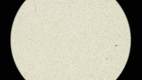 Colony of bacteria spirochetes under a microscope Stock Footage 96017467