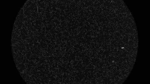 Colony of bacteria spirochetes under a microscope Stock Footage 96018741