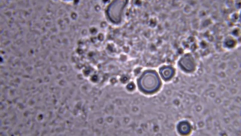 A colony of bacteria under a microscope. Magnification of about 1000x Stock Footage