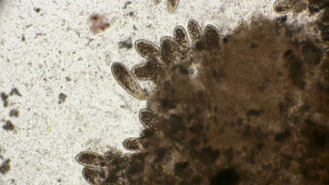 A colony of ciliates fed by Archea bacteria, which give a pink color to the Video stock 94505968
