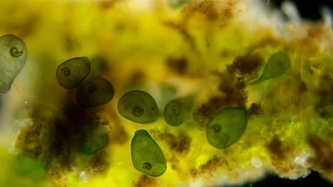 Colony Infusoria Stentor under the microscope, the family Stentoridae, class Stock Footage 131821418
