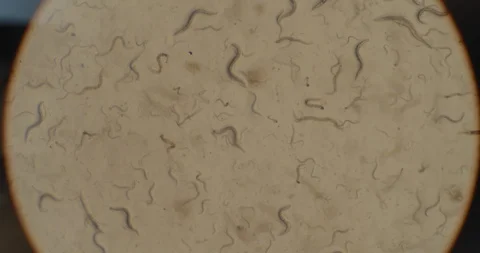 A colony of microorganisms, c-elegans nematode worms under the microscope, macro Stock Footage 120982250