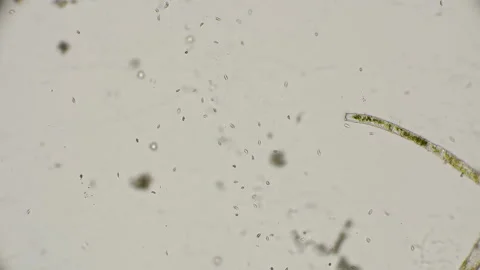 Colony of the simplest microorganisms including parasites under a microscope Stock Footage 92054493