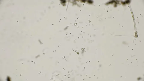 Colony of the simplest microorganisms including parasites under a microscope Video stock 92054573